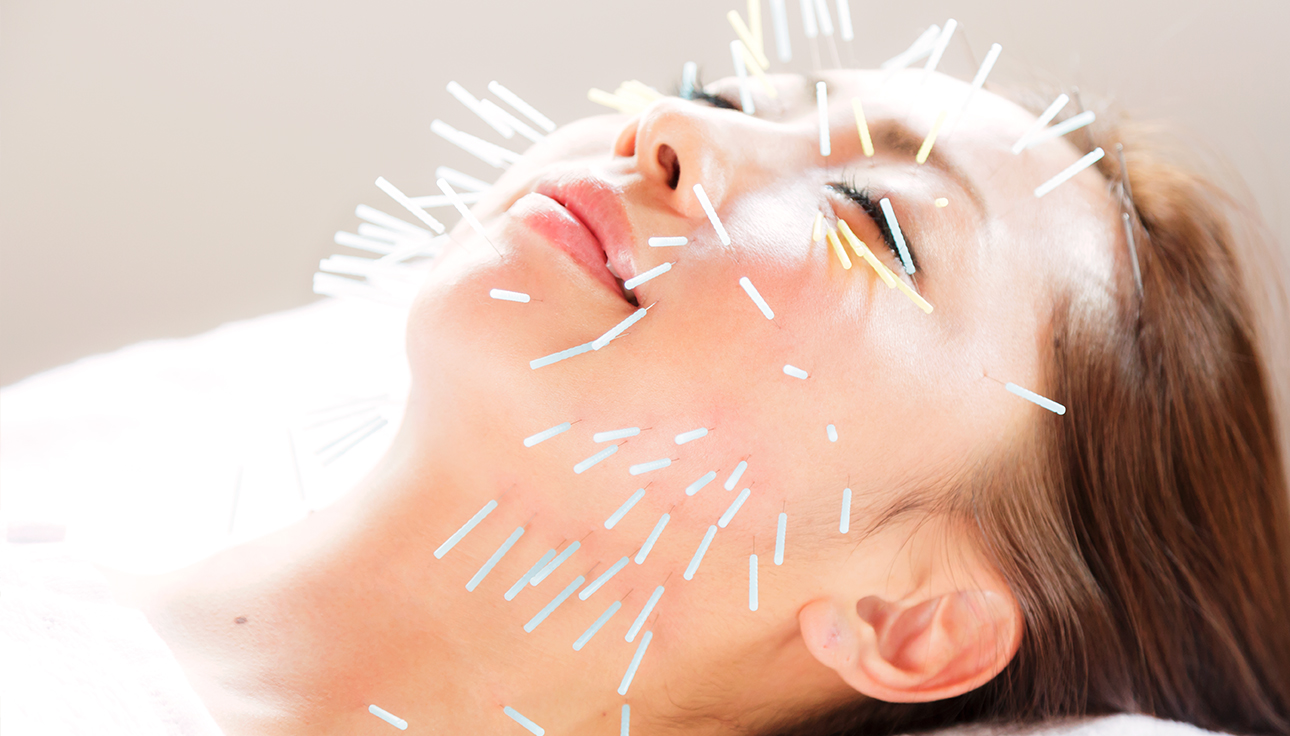 お顔に約100本の鍼を使用する効果に特化した当院独特の
				技術