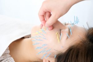 美容鍼灸 グラン治療院東京