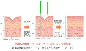 コラーゲン産生
