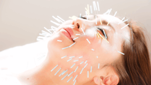 未来の美容鍼_光バイオ美鍼_5_美容鍼灸