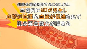 未来の美容鍼灸_42_血流中に一酸化窒素（NO）が発生