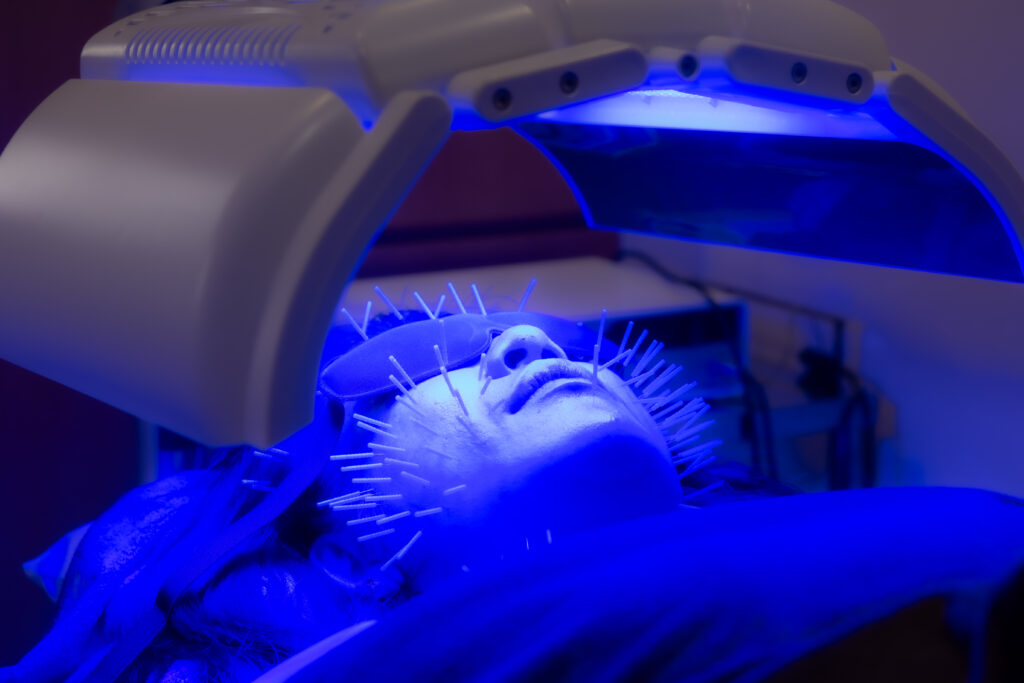 美容鍼灸LED照射（青色）