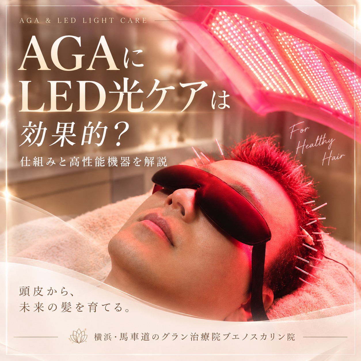 AGAにLED光ケアは効果的？横浜の育毛鍼灸院グラン治療院ブエノスカリン院が解説