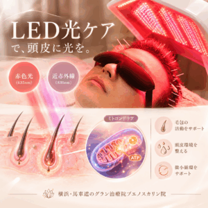 AGAに対するLEDの光ケアとは?